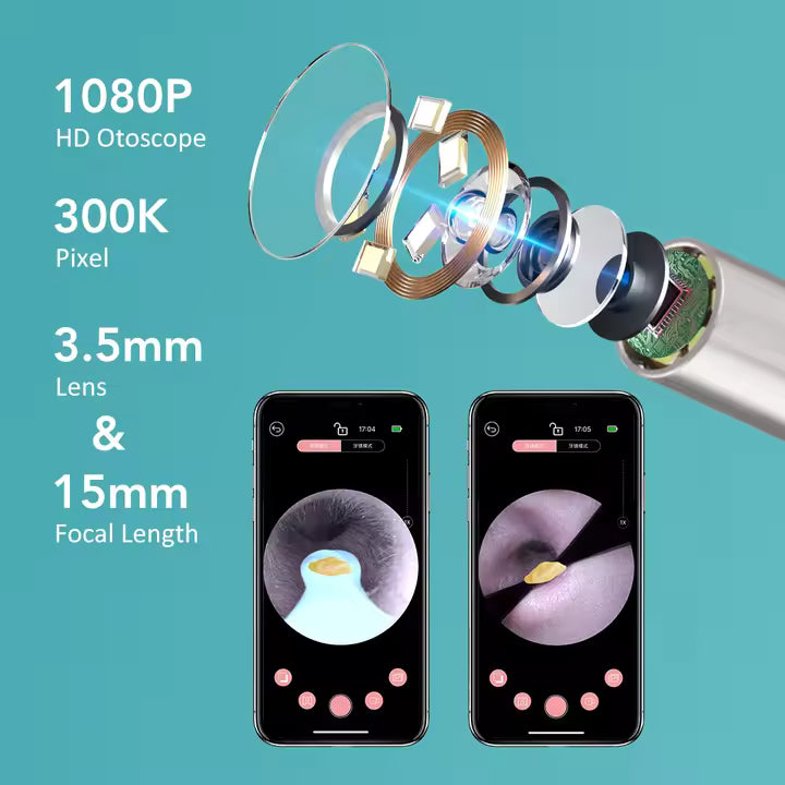 Limpia tus oídos con total seguridad